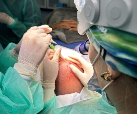 Trasplantes de pelo: ¿qué técnica será la más idónea?