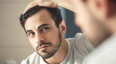 ¿La alopecia es heriditaria?