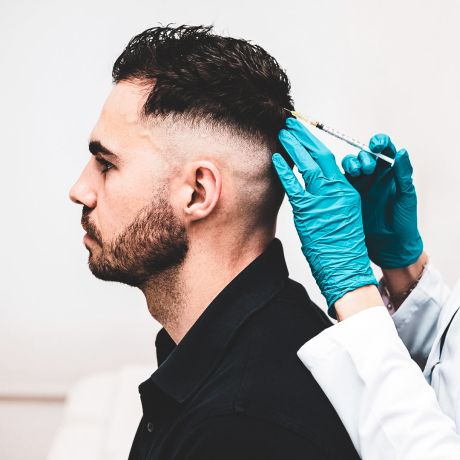 Riesgos de realizarse un trasplante de pelo por no profesionales