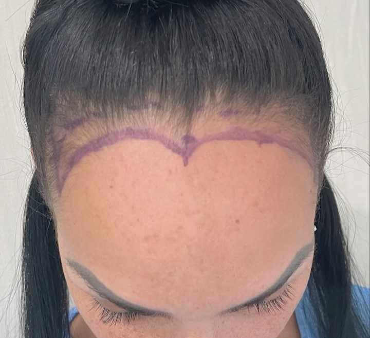 diseño capilar mujer