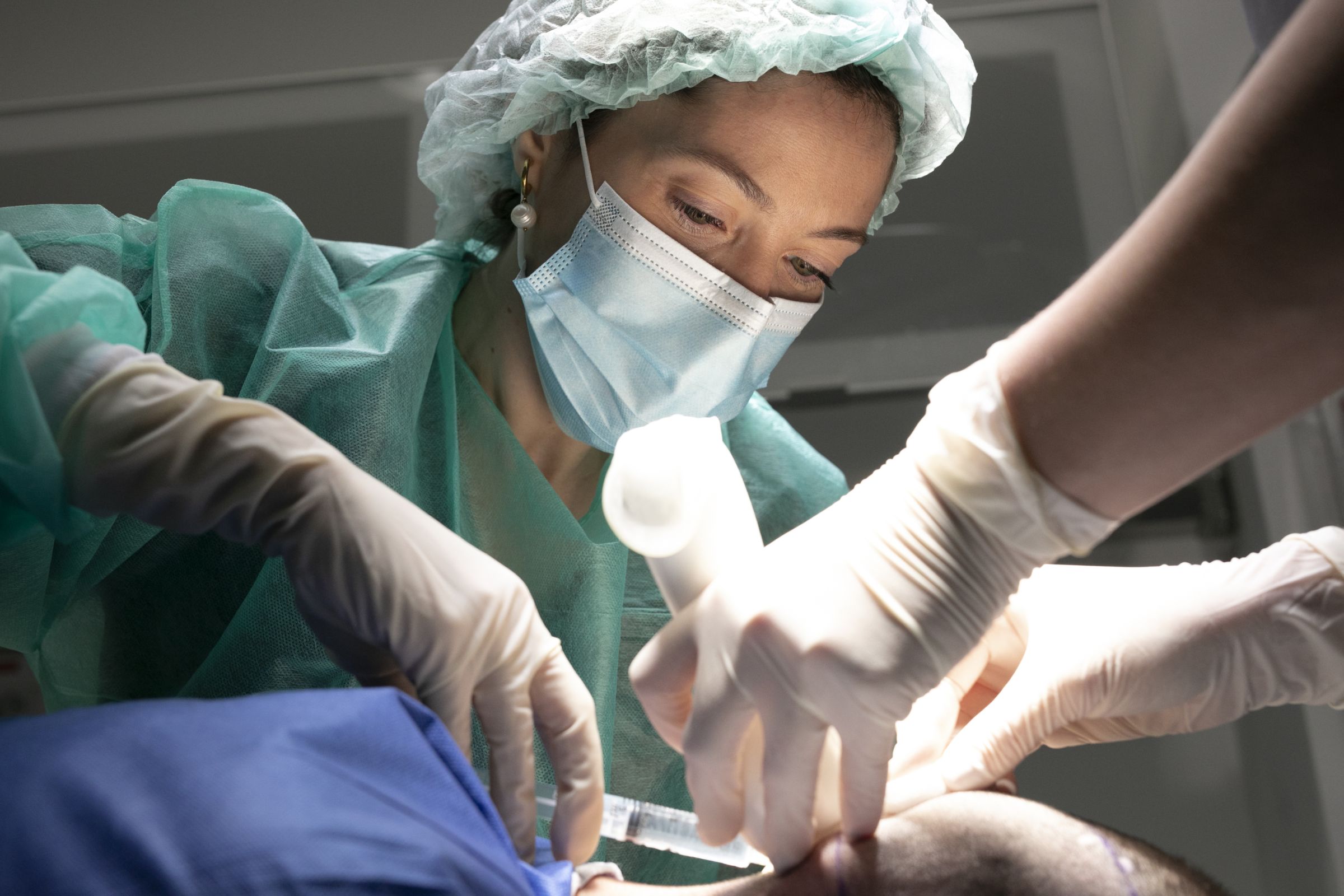 ¿Es recomendable alguna época del año para hacerse un tratamiento de cirugía capilar?