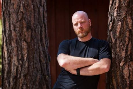 Testosterona y alopecia masculina