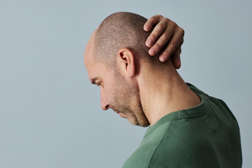 Trasplante de pelo: ¿quién ha dicho miedo?