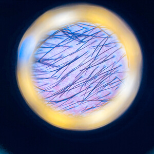 Pack Médico Anual + TrichoScan + Mesoterapia Capilar anual