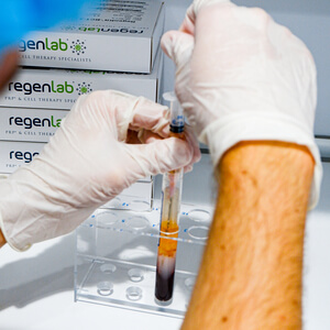 tratamiento plasma rico en plaquetas