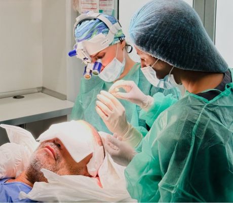 ¿En qué consiste el trasplante de pelo de autor?